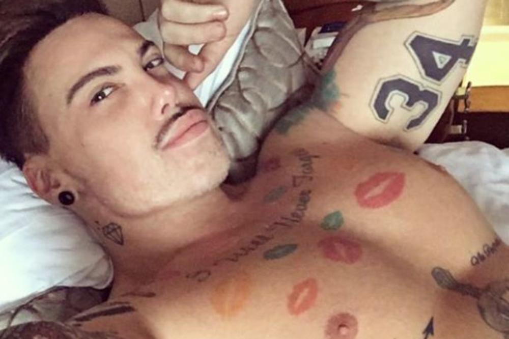 OPERACIJA NOSA RIJALITI UČESNIKU NAPRAVILA PAKAO OD ŽIVOTA! Nije mogao da OBUZDA EREKCIJU, doktori bili u šoku!