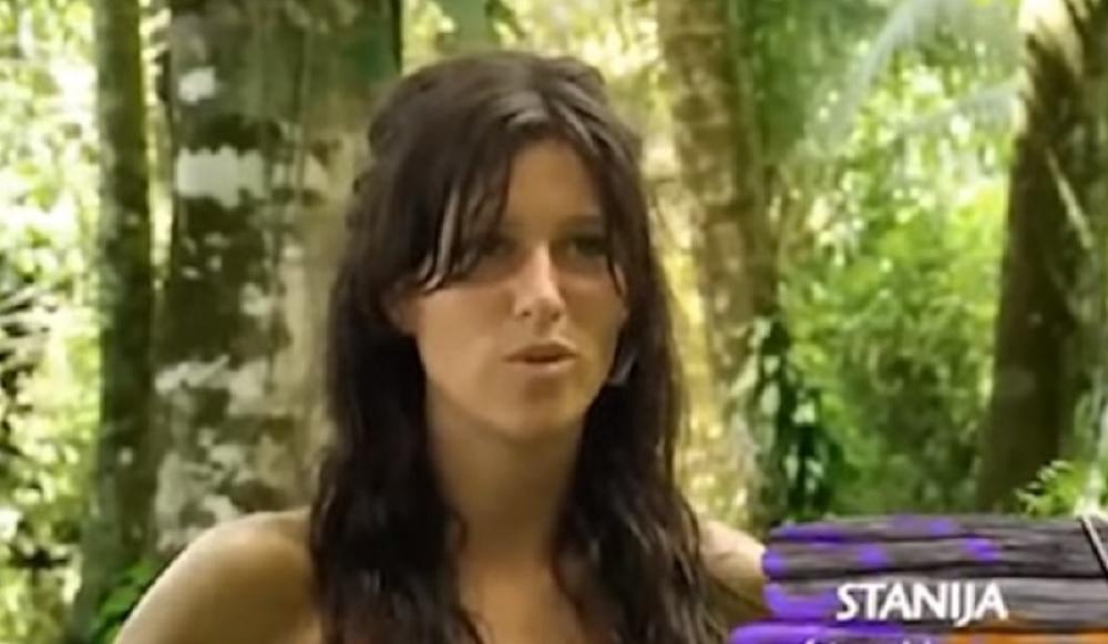 Stanija pre plastičnih operacija  