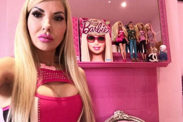 IMALA JE 17 OPERACIJA DA BI POSTALA LJUDSKA BARBIKA: A tek kad vidite kako je izgledala pre transformacije! (FOTO)