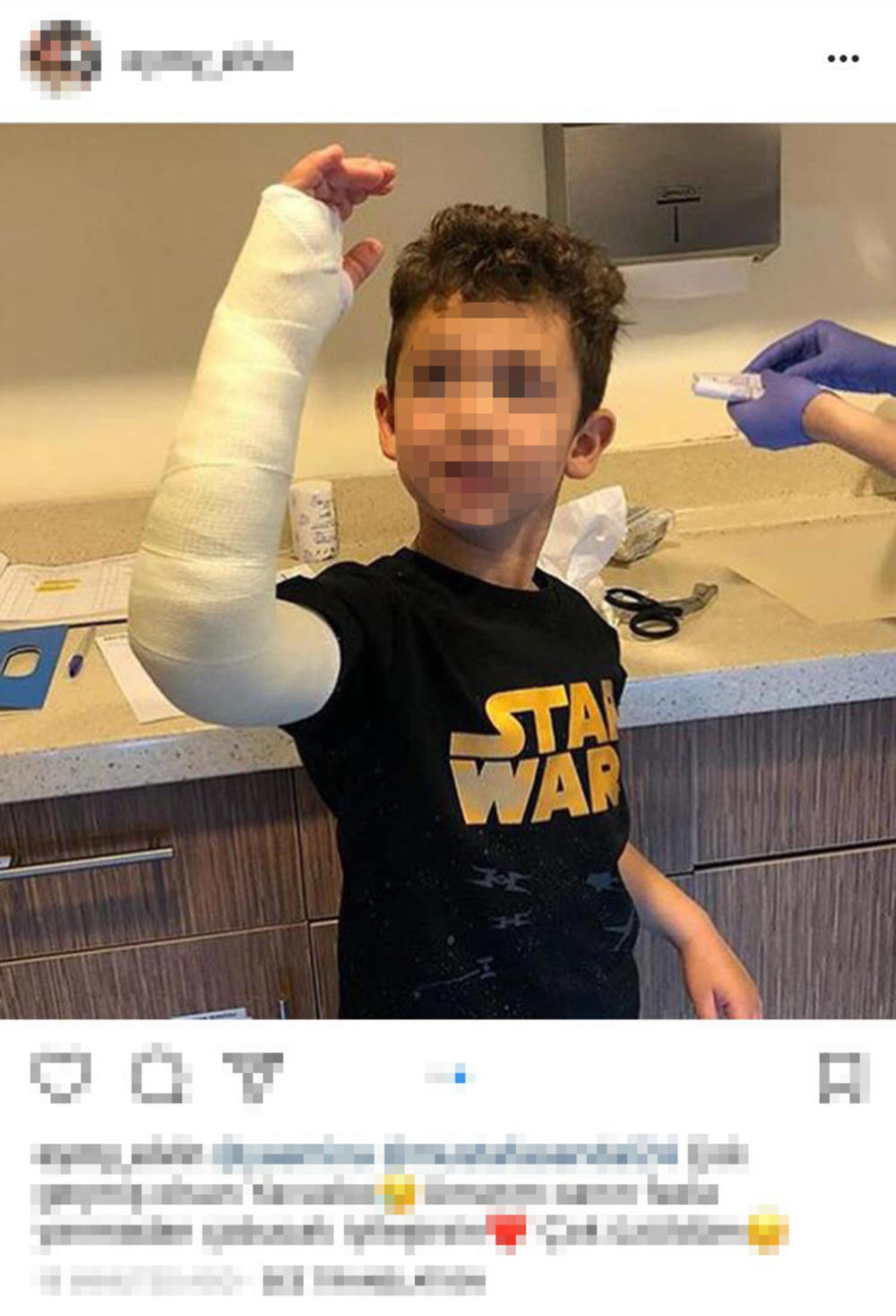 Eminin mlađi sin, Javuz, povredio je ruku  