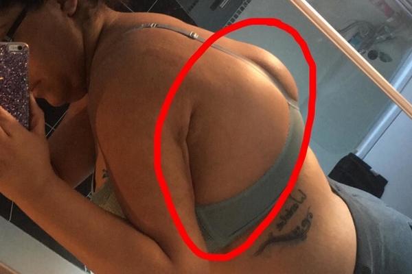 BOLELO JE DESNO RAME: A onda je otkrila STRAŠNU ISTINU! (FOTO)