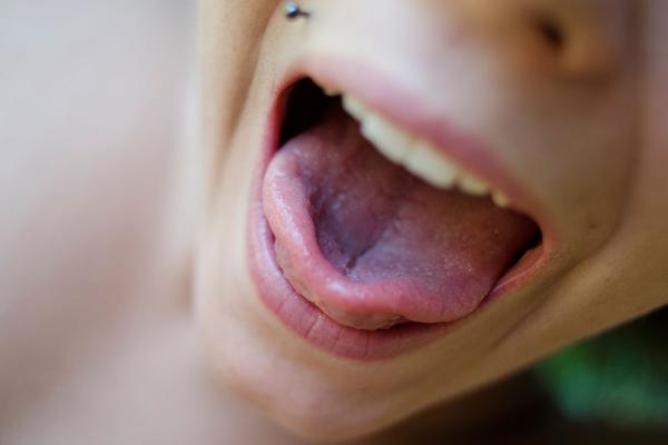 DEČAK ZBOG SLATKIŠA KOJI SRBI DAJU DECI JEDVA IZVUKAO ŽIVU GLAVU: Doslovno je dobio OPEKOTINE - jezik mu se LJUŠTIO