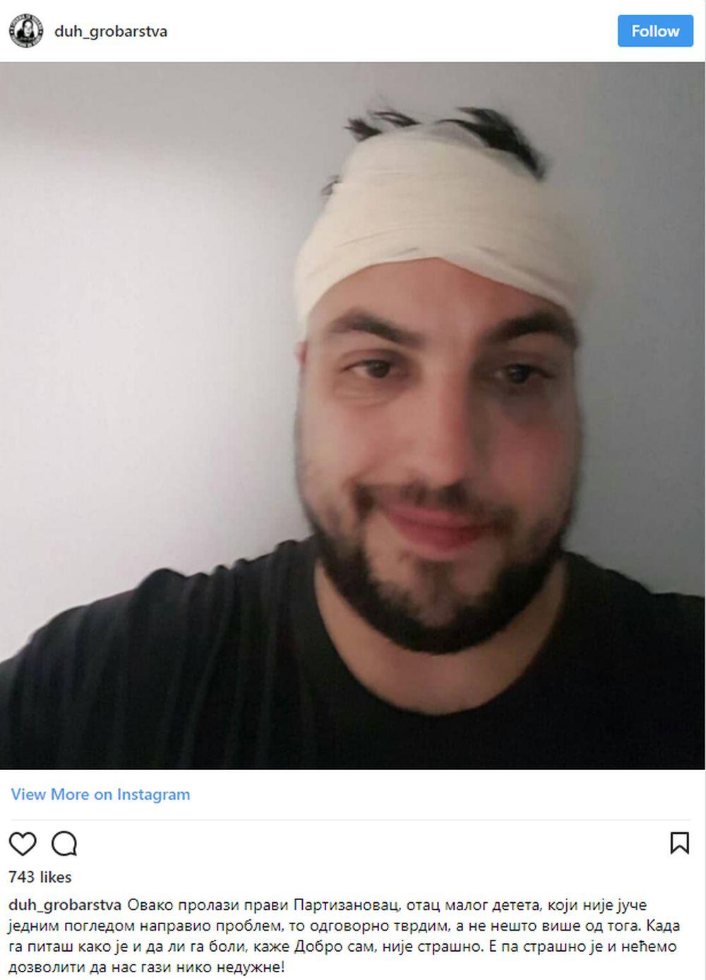 Miloš Radisavljević Kimi sa povredama posle 157. Večitog derbija