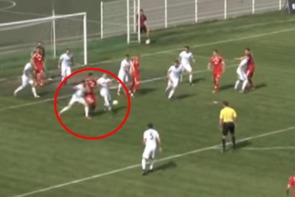 POSLEDICE STRAVIČNE POVREDE: Fudbaler Čuke se hrani na SLAMČICU! (FOTO) (VIDEO)