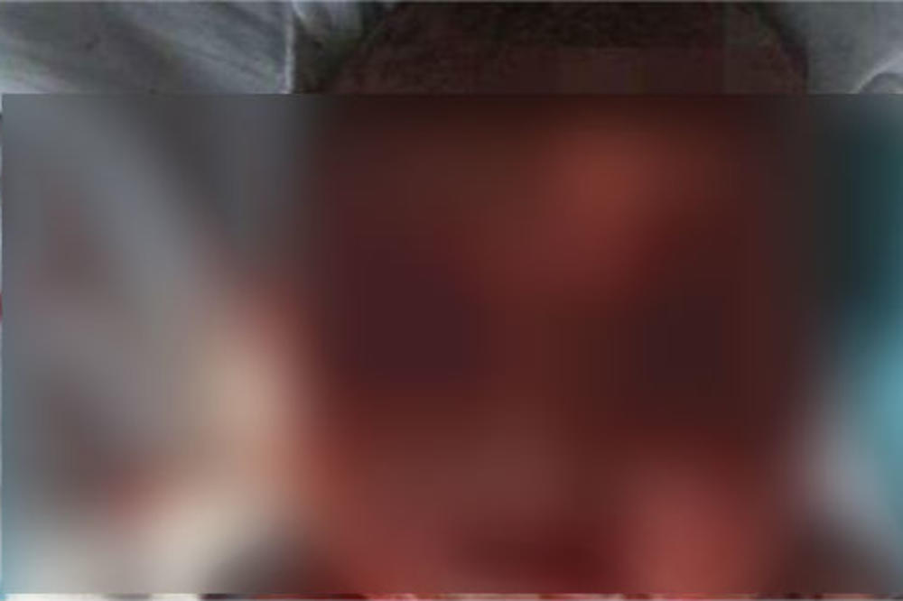 ČIREVI SE ŠIRE MUNJEVITOM BRZINOM: Majka je poljupcem u usta zarazila bebu, a onda je nastao PAKAO! (FOTO)