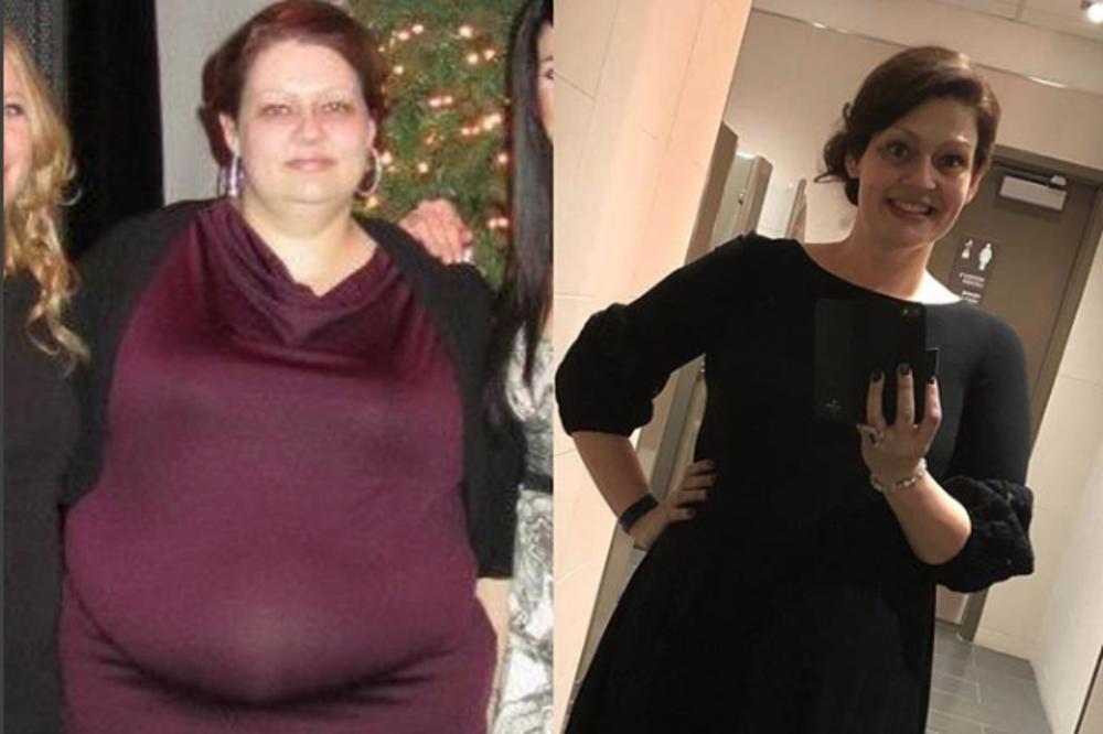 OD BUCE DO LEPOTICE: Za dve godine je smršala 150 kilograma, a poštovala je samo OVE TRI STVARI (FOTO)