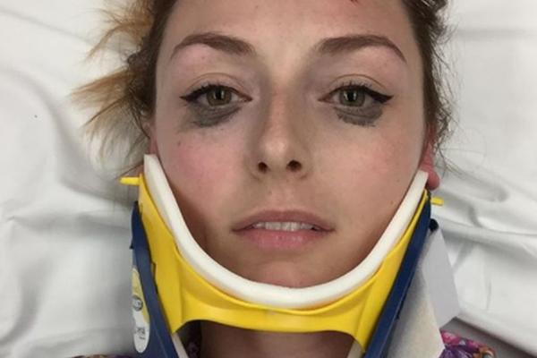 Objavila SELFI odmah nakon nesreće, a svi su primetili samo OVAJ DETALJ! (FOTO)