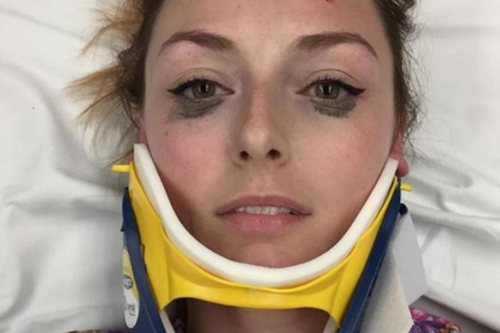 Objavila SELFI odmah nakon nesreće, a svi su primetili samo OVAJ DETALJ! (FOTO)