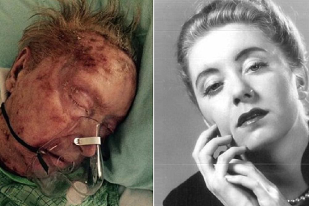 ŠUGA JE ŽIVU POJELA! Prelepa manekenka UMRLA na NAJJEZIVIJI NAČIN! (UZNEMIRUJUĆE FOTOGRAFIJE)