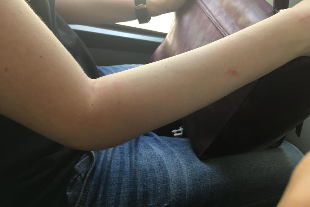 OVO SU PRIRODNA I JEFTINA REŠENJA PROTIV DOSADNIH KOMARACA: Banane, maslinovo ulje i limun će vam pomoći!