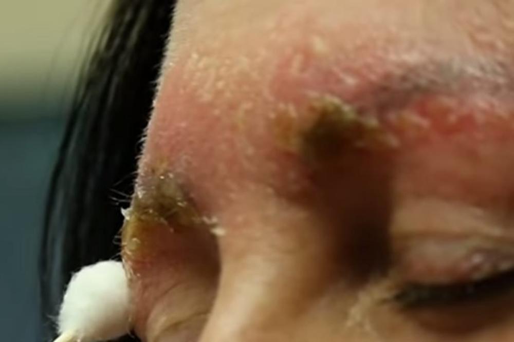 PRESELO JOJ ULEPŠAVANJE: Otišla je na japansko iscrtavanje OBRVA pa završila u BOLNICI (FOTO) (VIDEO)