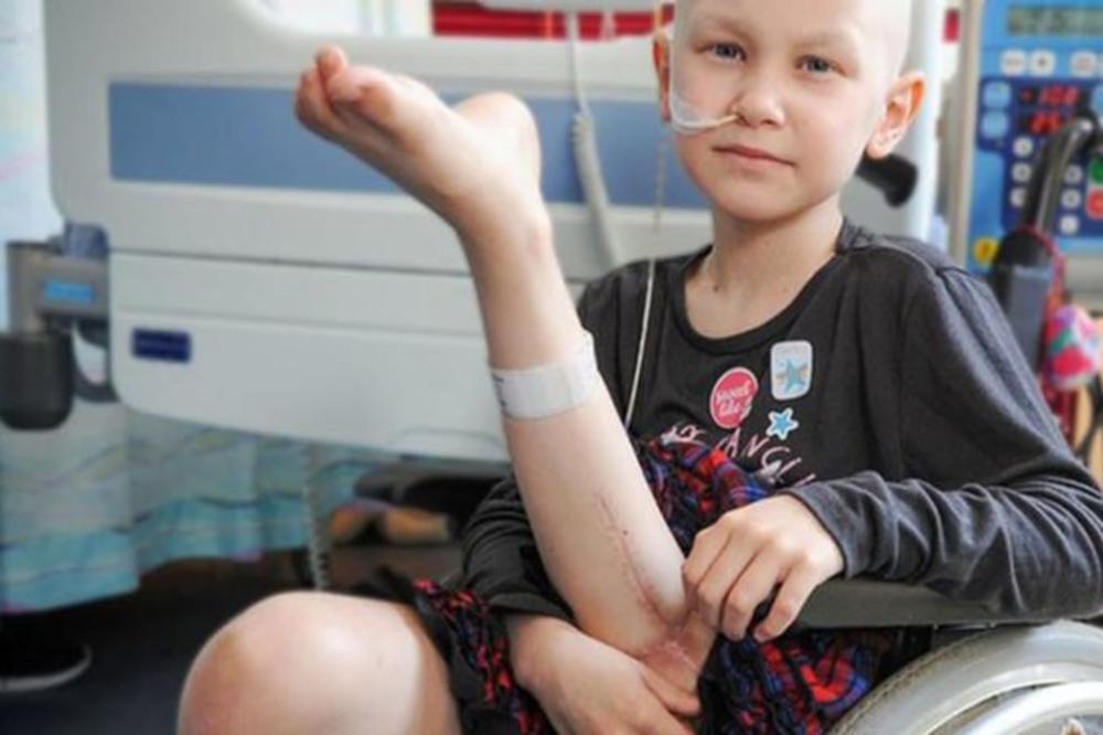 DEVOJČICI (7) DOKTORI NAOPAKO PRIŠILI NOGU: Zbog tumora su obavili amputaciju a onda iz OVOG razloga učinili nešto neverovatno (FOTO)