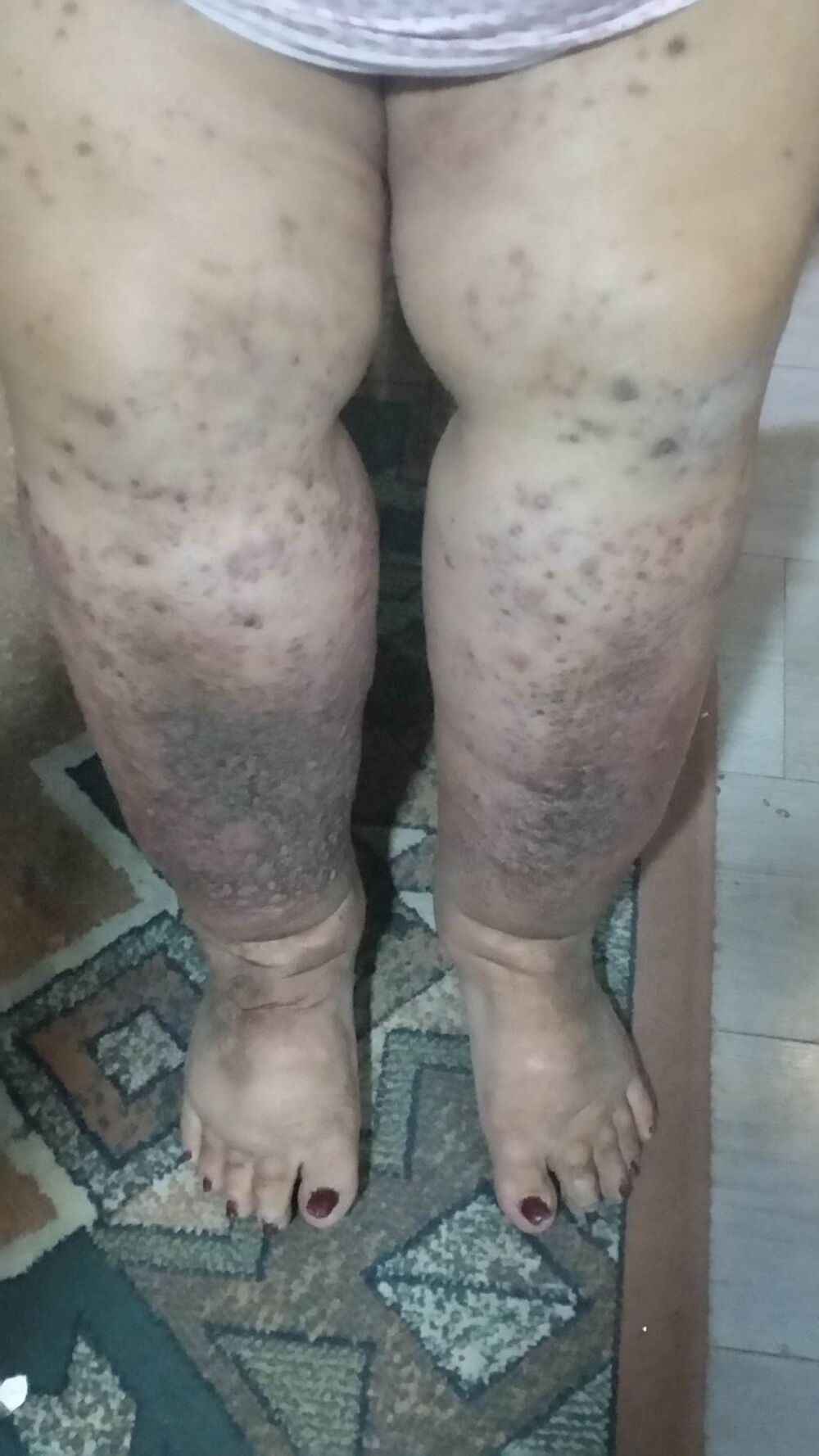 Zorica Azirović je pretrpela PAKAO zbog greške lekara