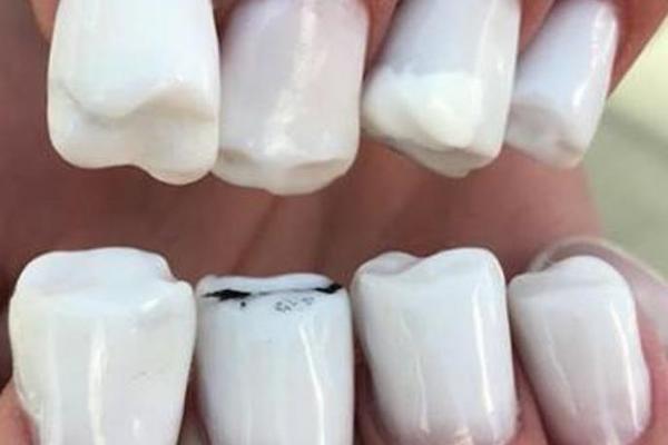 NE, OVO NISU ZUBI! Nikada nećete pogoditi šta je na slici! (VIDEO)