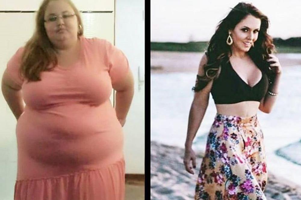 SMRŠALA JE 90 KILOGRAMA I POSTALA ZVEZDA: Bila je nesrećna, ali joj je JEDNA ODLUKA promenila život! (FOTO)