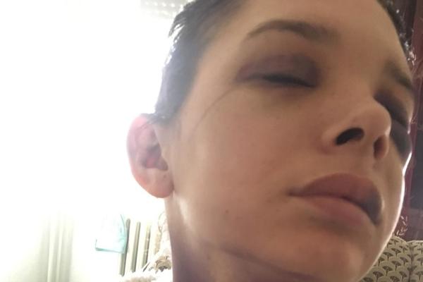 ALBANAC ME JE PREBIO JER NISAM HTELA DA SPAVAM S NJIM! Trudna Anđela DOŽIVELA HOROR NA KOSOVU (UZNEMIRUJUĆI FOTO)