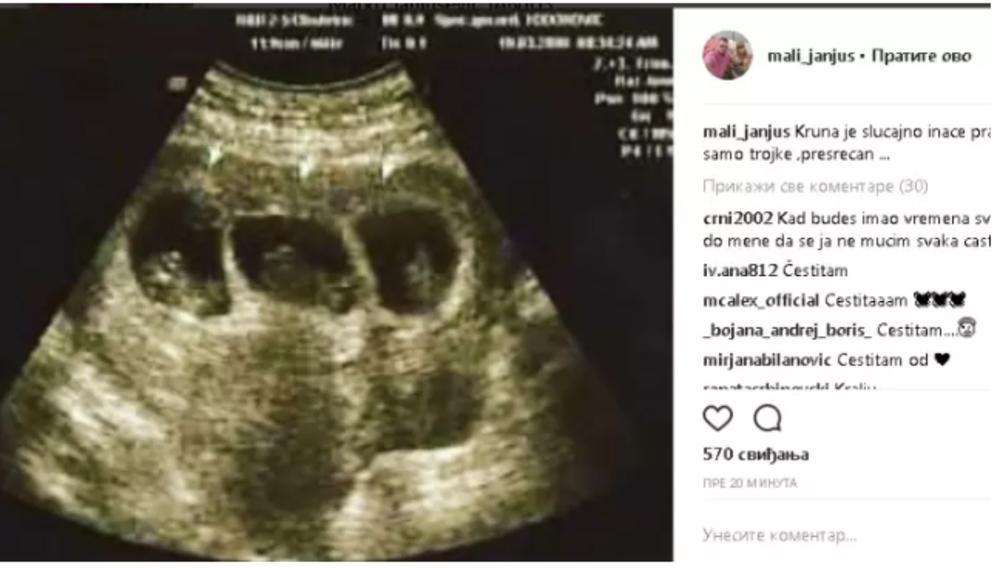 Janjuš se pohvalio slikom ultrazvuka  