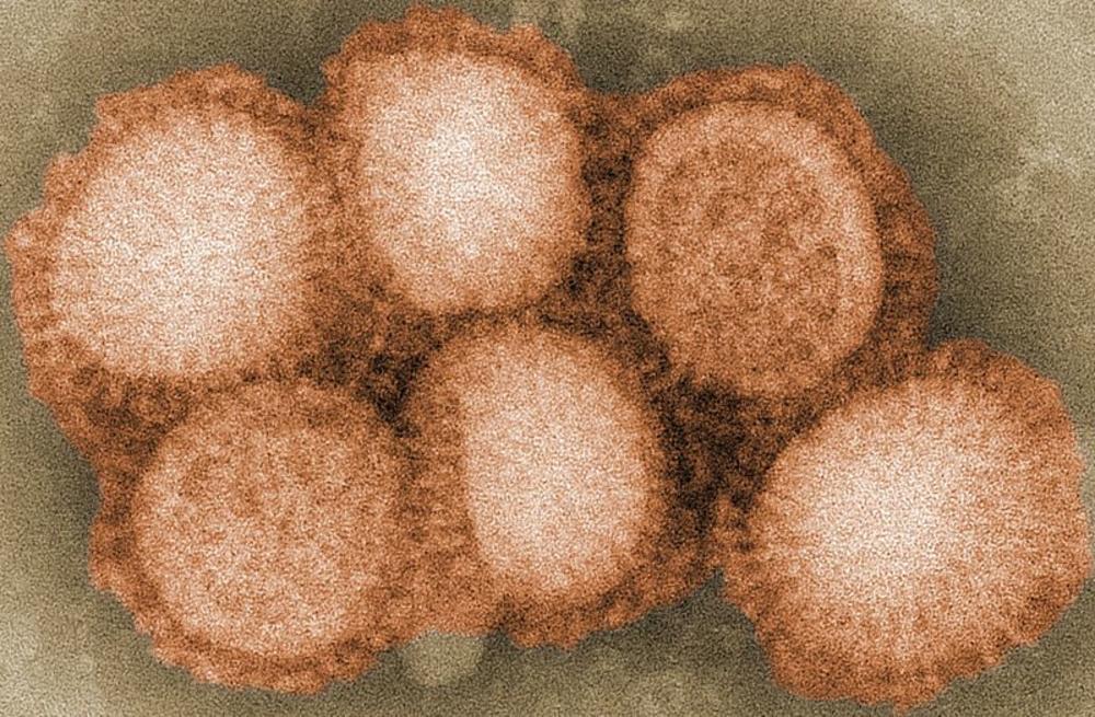 H1N1 virus  