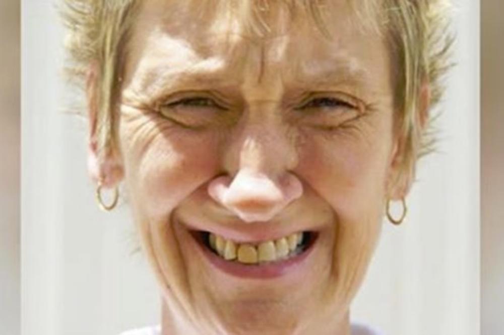 CEO ŽIVOT SU JE ISMEVALI ZBOG NOSA: Onda je doživela TRANSFORMACIJU koja je sve ostavila bez teksta! (VIDEO)