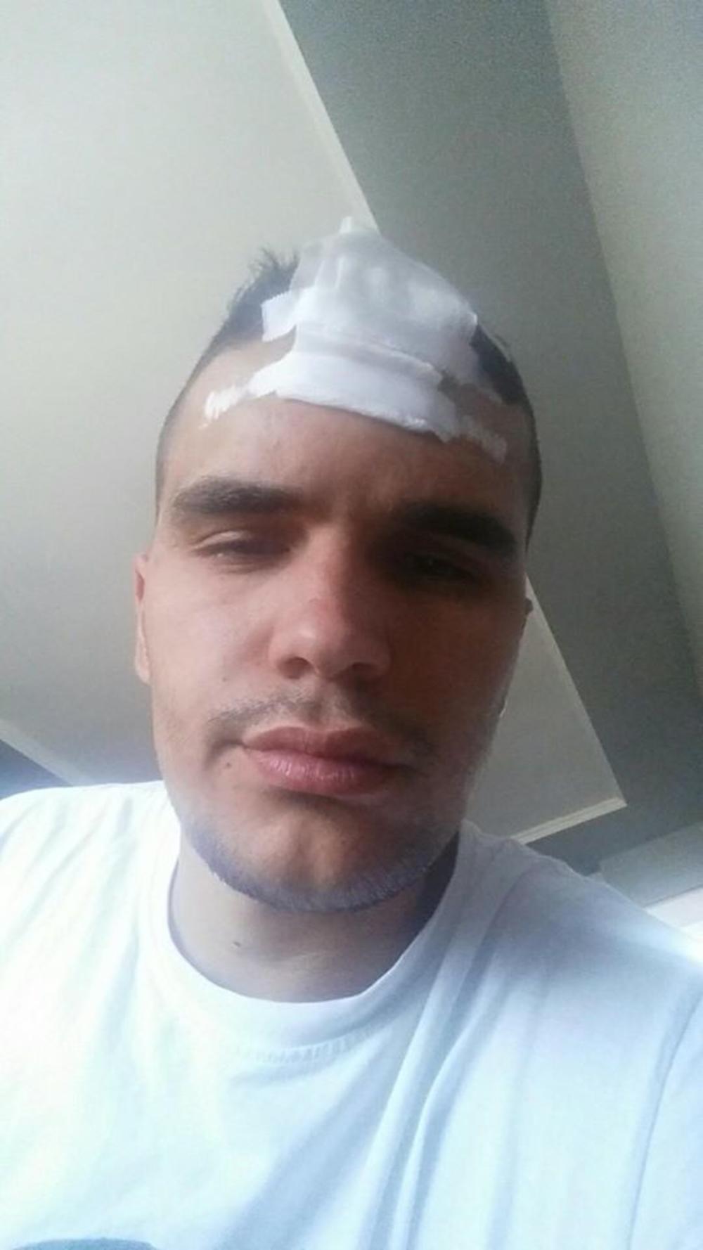 Četiri kopče su uspomena sa Kosova  