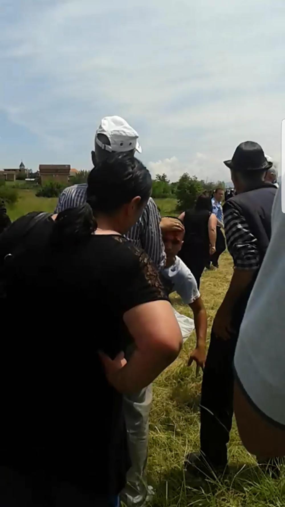 Albanci su ga pogodili kamenom u glavu  