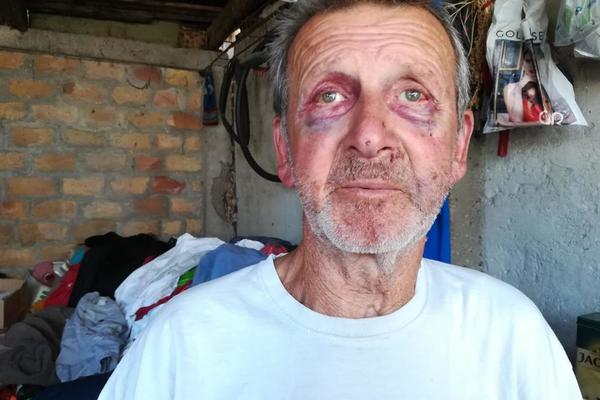 SRCE DA PREPUKNE, SRBIJO! Progovorio Mišo iz Stare Pazove koga je BRUTALNO IZUDARAO BAHATI HULIGAN IZ BMW-a! (UZNEMIRUJUĆI SNIMAK)