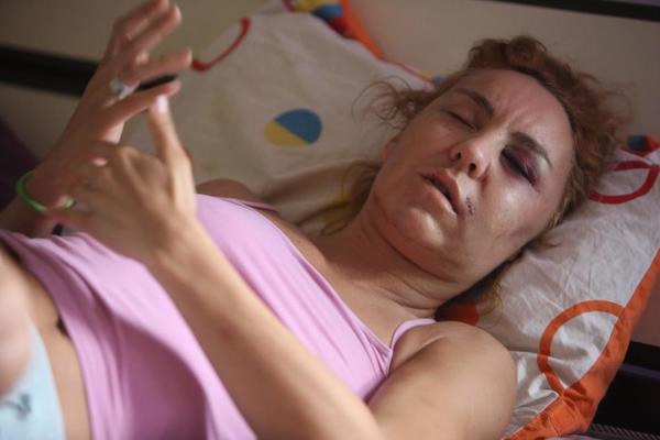 LJILJANA JE SA SUZAMA U OČIMA ISPRIČALA KAKO JU JE DEČKO BOKSER PRETUKAO: Izašao je, skinuo majicu i vezao je oko pesnice! (VIDEO)