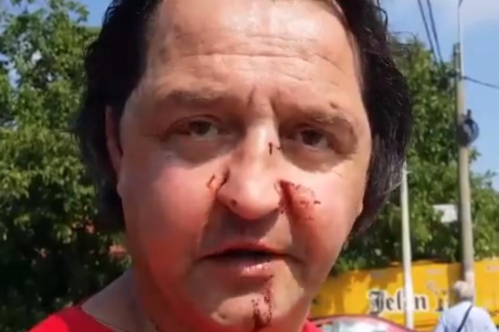 OTELI SU MI TORBU, PRETUKLI ME I UZELI MI 300 EVRA: Incident na protestu protiv poskupljenja goriva (VIDEO)