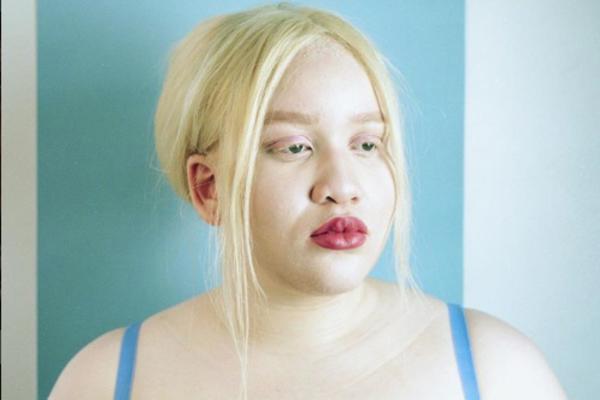 SVI SU JE PROZIVALI DA IZGLEDA KAO KASPER! Pokušala je da se UBIJE, a onda se sve promenilo!