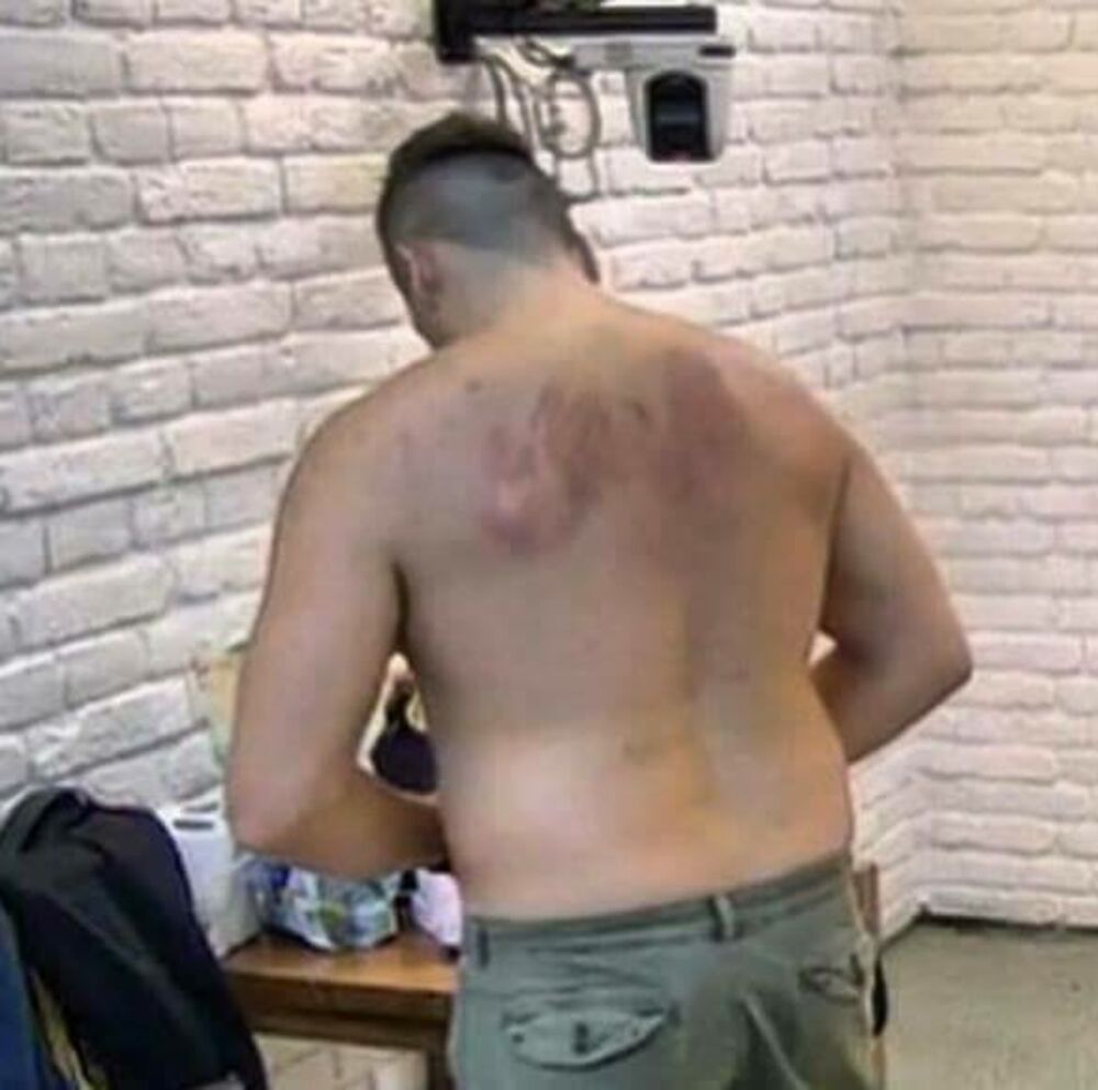 Rane koje je Kija vidala  