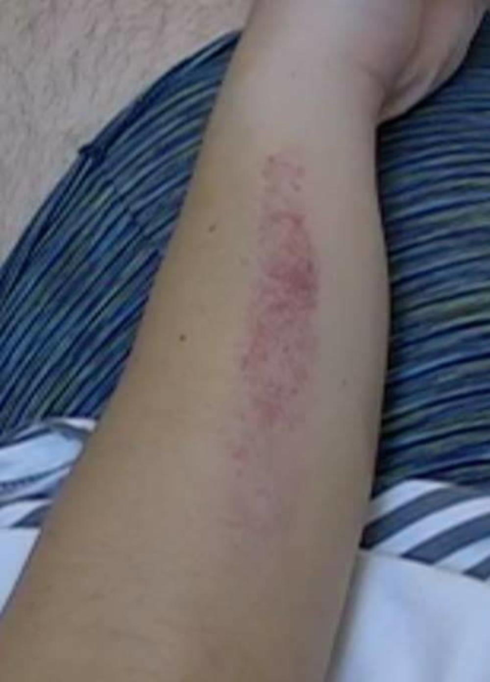 Luna je sinoć fizički nasrnula na Slobu  