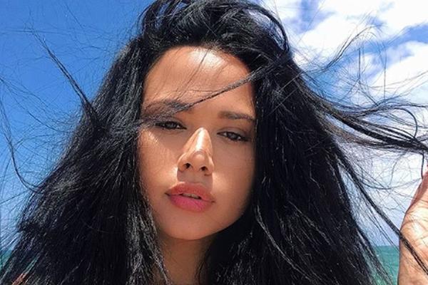 One imaju CELULIT i ne stide se da ga pokažu! Za to imaju dobar RAZLOG, a inspiracija su mnogim ženama! (FOTO)