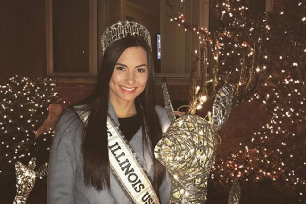 MISICA JE OBOLELA OD RAKA KOŽE: Bila je ŠOKIRANA kada je saznala od čega! OVO SIGURNO I VI RADITE!