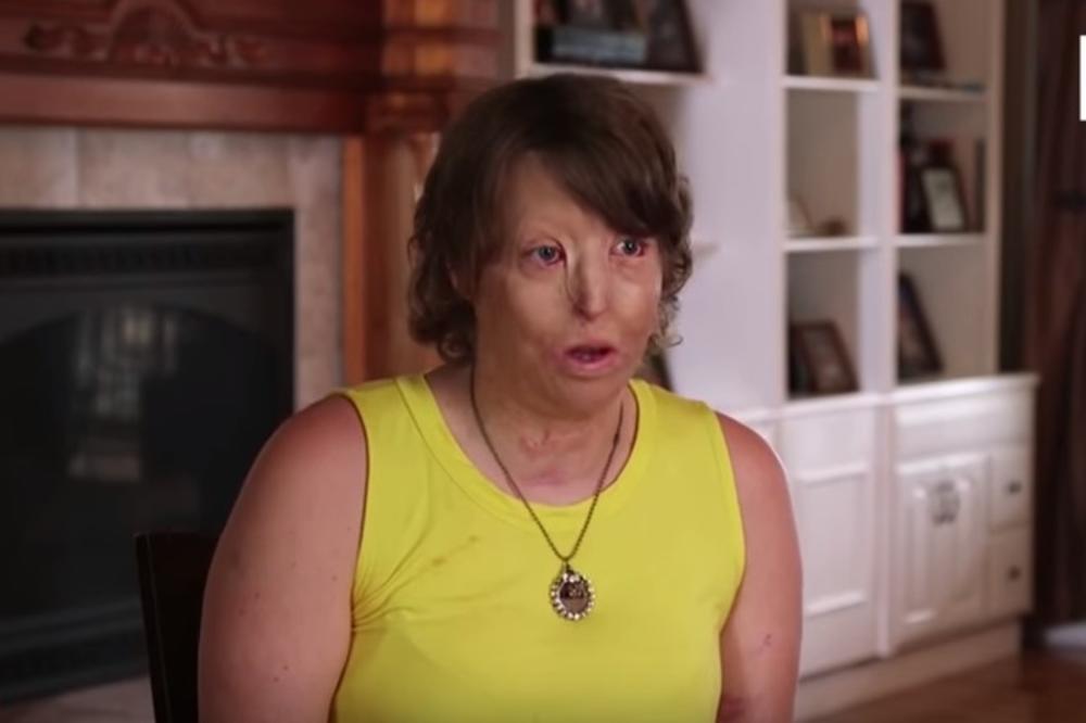 PRVO JE UNAKAZIO, PA URADIO NEŠTO JOŠ GORE! Krenula je mužem na kampovanje s kog se vratila SPALJENA, a onda je počela njena životna agonija (VIDEO)