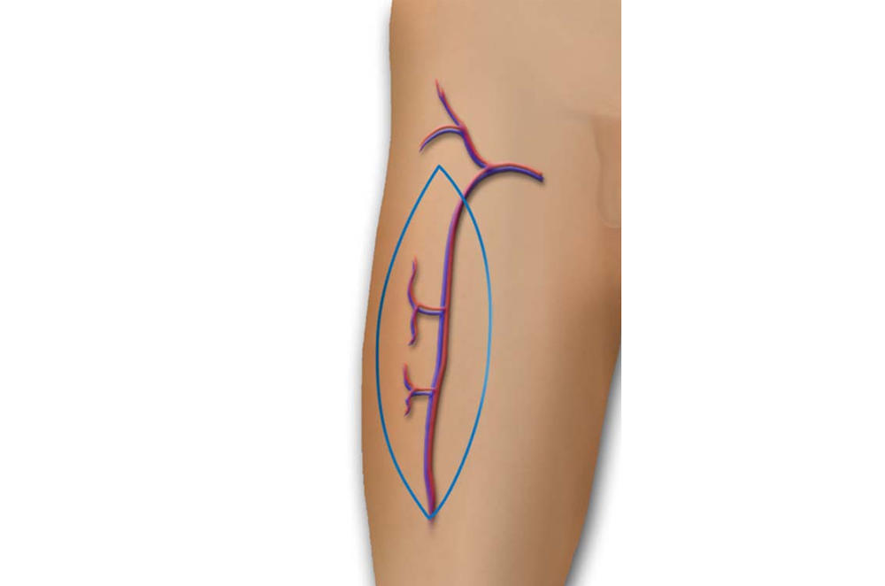 Operacija je trajala 10 sati  