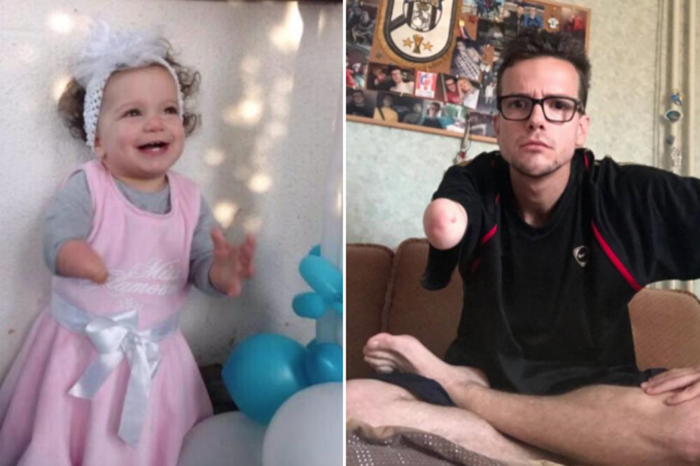 POKAZUJEM VAM IMAGINARNI SREDNJI PRST RUKOM KOJU NEMAM: Nenad je kao i Sofija rođen bez šake, a za vrtić koji devojčicu nije hteo da primi ima kratku i jaku poruku! (FOTO)