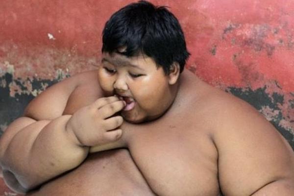 IMAO JE 192 KILA I OPERACIJA JE BILA JEDINO REŠENJE: Najdeblji dečak na svetu danas je NEPREPOZNATLJIV! (VIDEO)