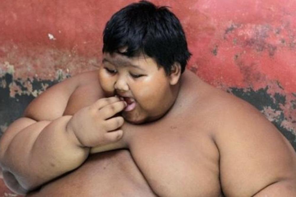 IMAO JE 192 KILA I OPERACIJA JE BILA JEDINO REŠENJE: Najdeblji dečak na svetu danas je NEPREPOZNATLJIV! (VIDEO)