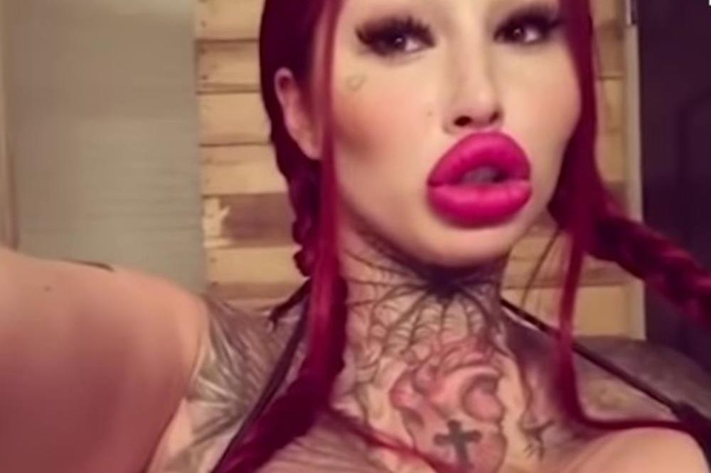 DEVOJKO, ŠTA TO URADI SA SOBOM?! Potrošila je 150.000 dolara na plastične operacije i sad izgleda NEOPROSTIVO! (FOTO)