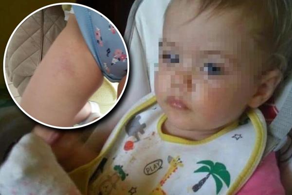 MOJU BEBICU LJILJANU SU PRETUKLI U VRTIĆU, a objašnjenje koje sam dobila je BAŠ SKANDALOZNO! (FOTO)