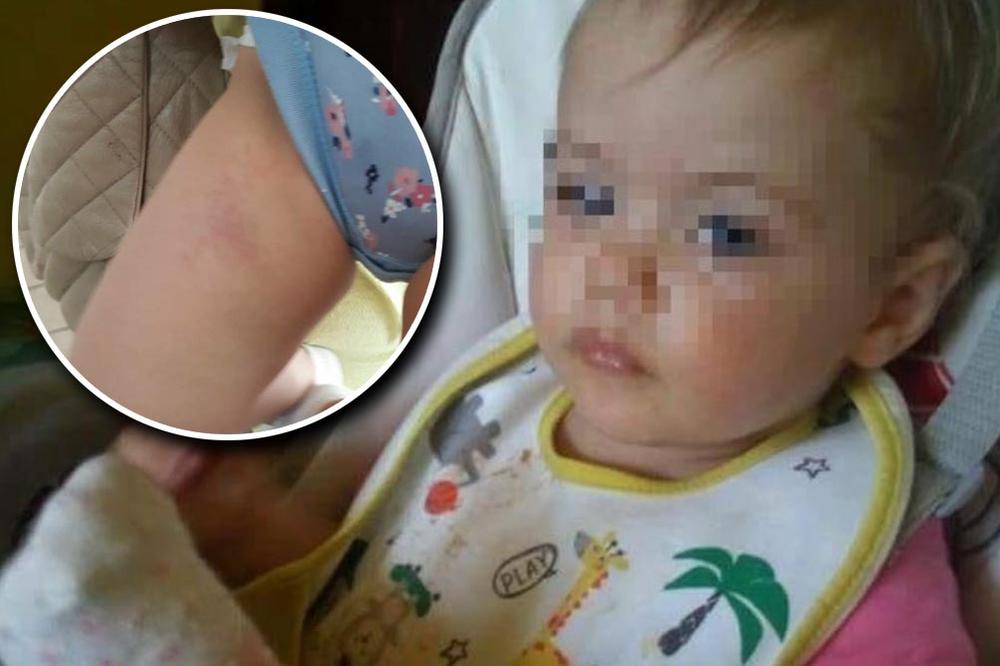 MOJU BEBICU LJILJANU SU PRETUKLI U VRTIĆU, a objašnjenje koje sam dobila je BAŠ SKANDALOZNO! (FOTO)