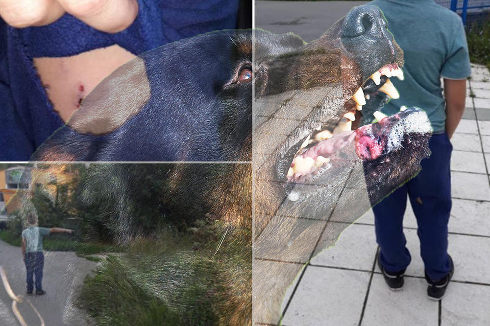 DA LI ĆE SADA NEKO KONAČNO DA REAGUJE? Još jedno dete izujedano u HOROR ŠKOLI NA PERIFERIJI BG-A! (FOTO)