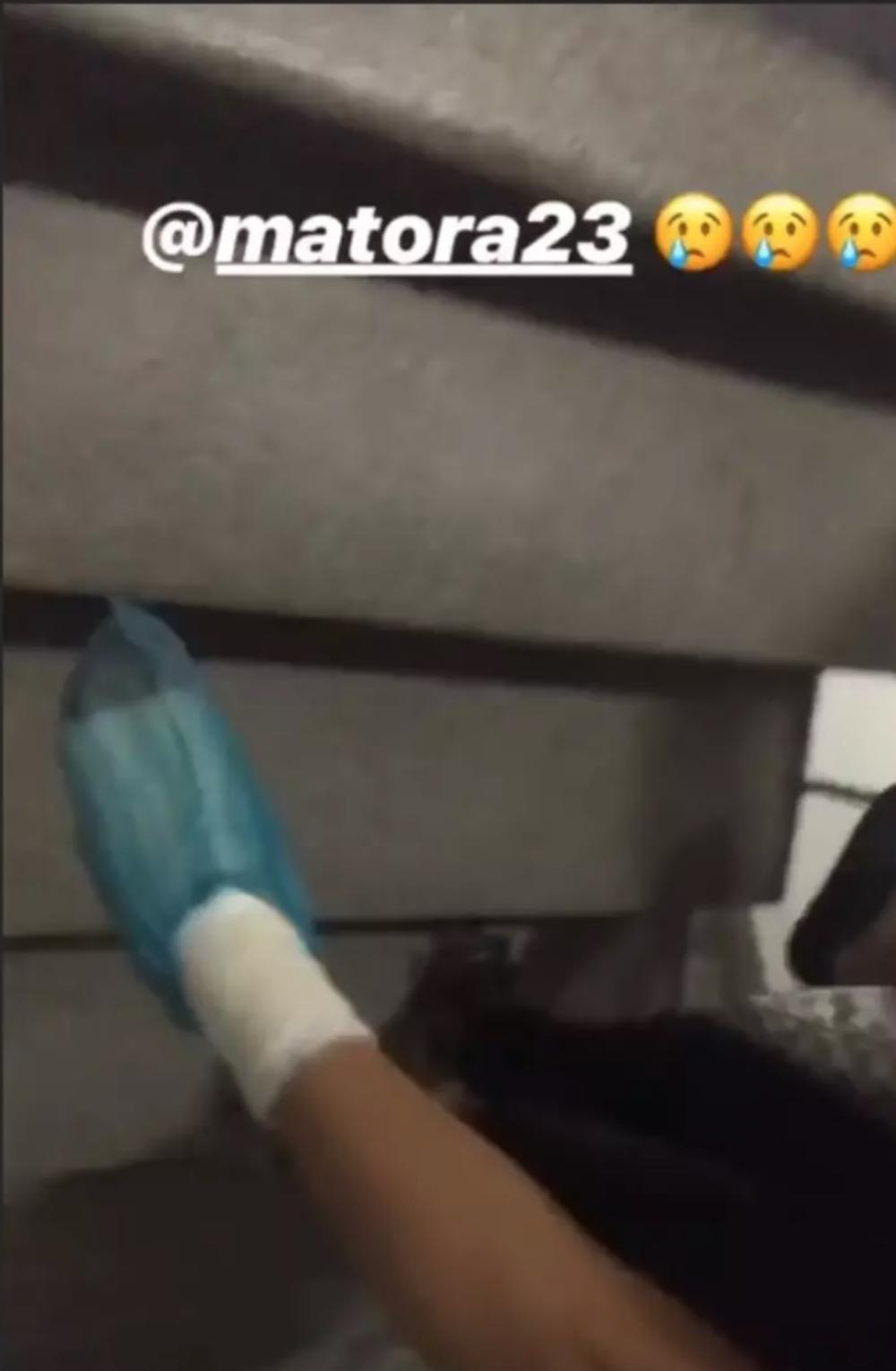 Sanja povredila nogu   