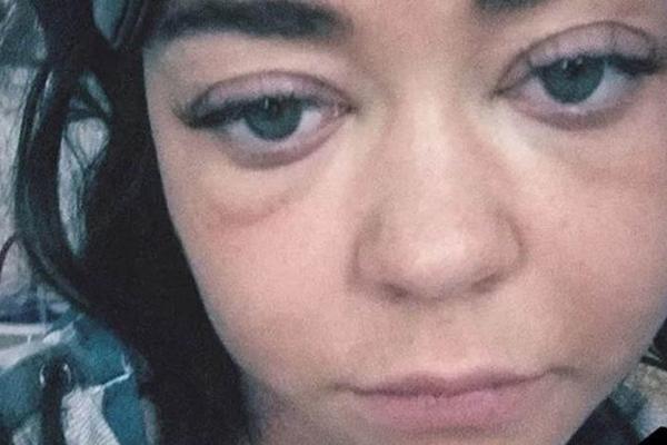 NEKAD JE BILA NAJLEPŠA LEPOTICA: Mlada glumica objavila POTRESNI SELFI i rastužila CEO SVET! (FOTO)