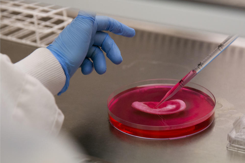 12 KRIVACA ZBOG KOJIH VAM HOLESTEROL NENORMALNO RASTE: Na većinu ne biste NI POMISLILI