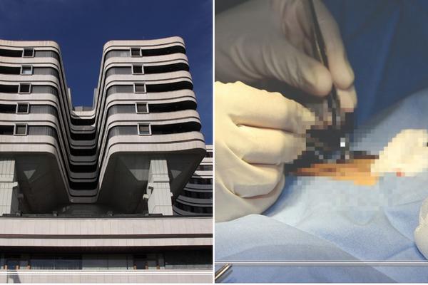 Lekari VMA odstranili tumor težak 18 kilograma: NESVAKIDAŠNJI ZAHVAT U BEOGRADU! (FOTO)