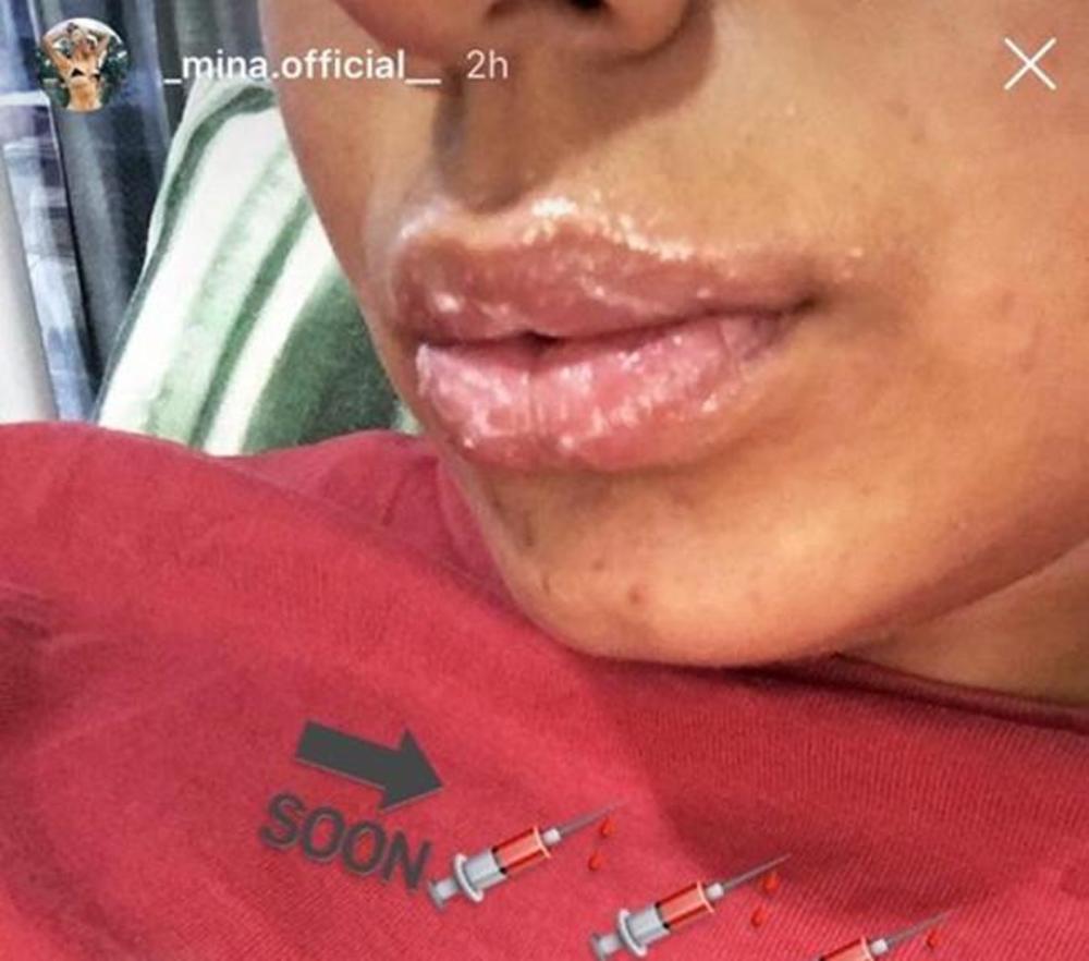 Mina Vrbaški korekcija  