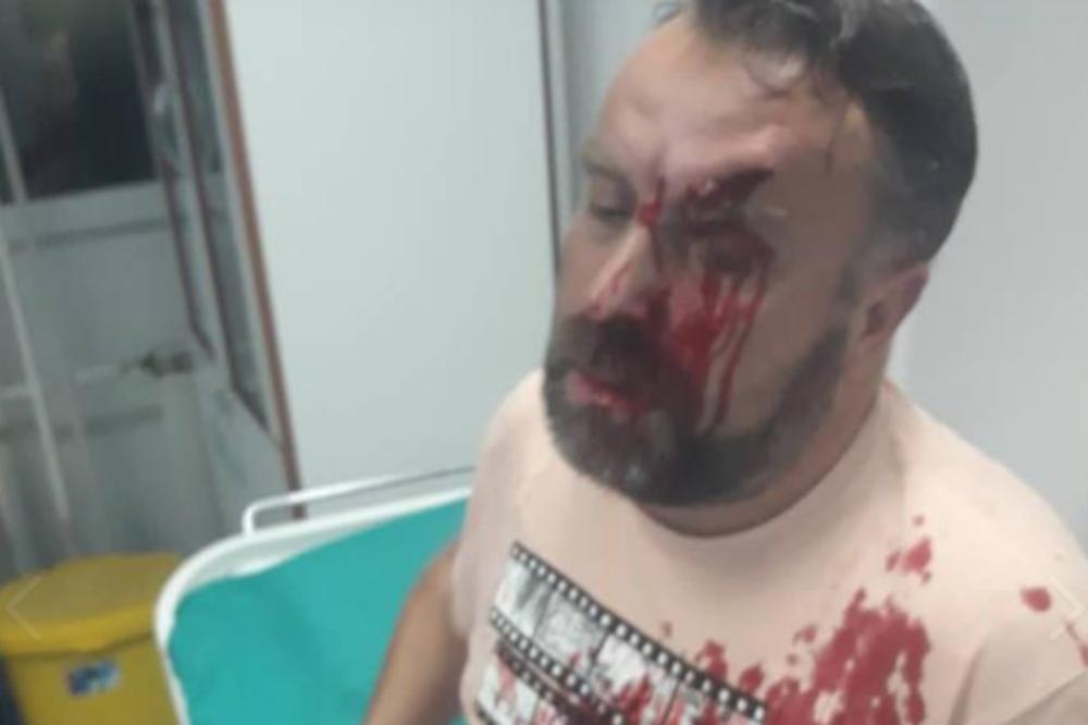 STEFAN CVETKOVIĆ SAV KRVAV I RAZBIJENE ARKADE: Novinar objavio uznemirujuću fotografiju iz bolnice, ŠTA SE OVO DESILO?!