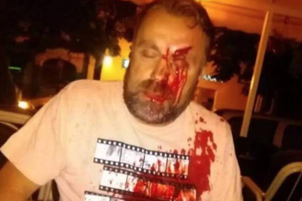 UHAPŠEN NAPADAČ NA STEFANA CVETKOVIĆA! Ispred kafića u Beloj Crkvi napao novinara i naneo mu LAKŠE TELESNE POVREDE!