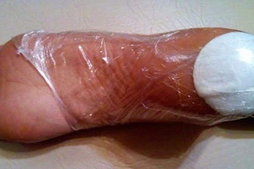 NA LETO SVI IMAJU OVAJ PROBLEM: Preko noći je stavljala vatu na stopala, kada vidite REZULTAT, odmah ćete uraditi isto!